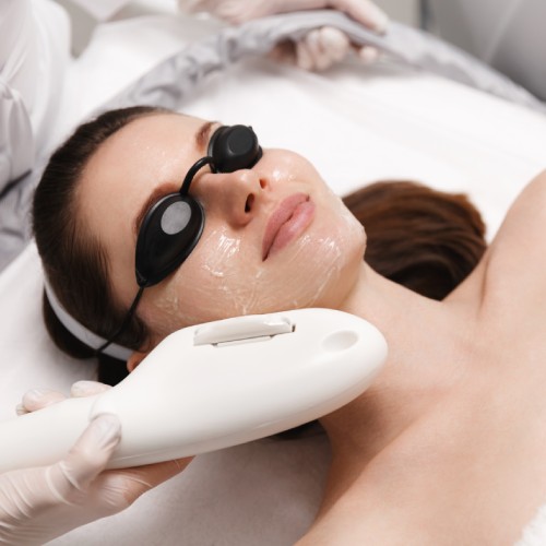 Photofacial treatment in progress