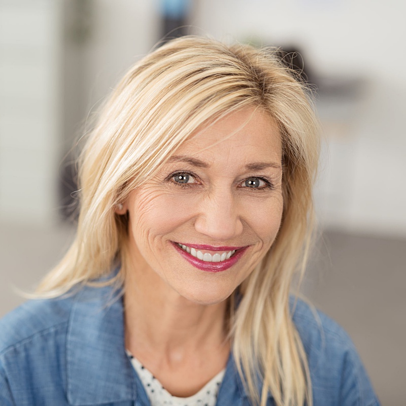 a blonde woman who received microneedling with prp