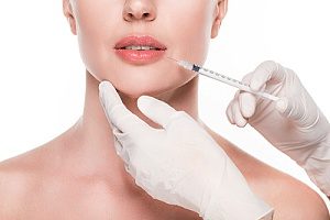 a Dysport injectable that is helping a woman have fuller lips