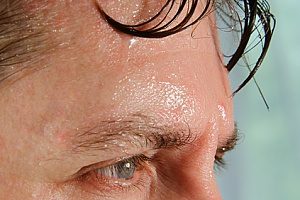 a man sweating excessively and will therefore receive Botox treatment