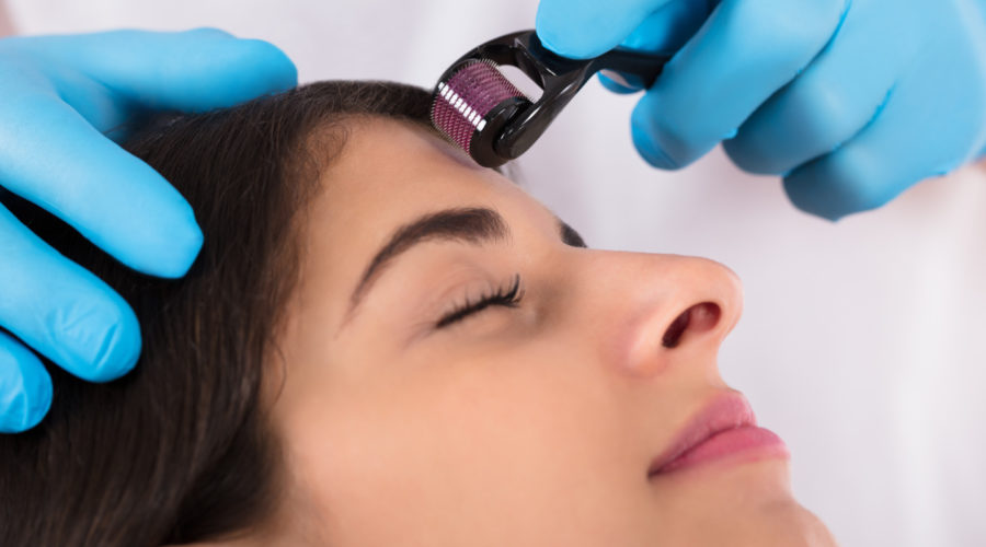 a woman getting microneedling on her forehead by a licensed esthetician