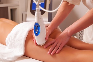 a woman getting venus legacy treatments for her cellulite