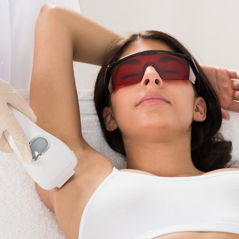Laser hair removal being applied to armpit