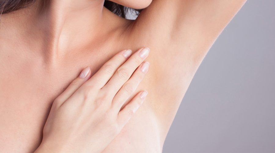 A Woman who received laser hair removal in her armpits