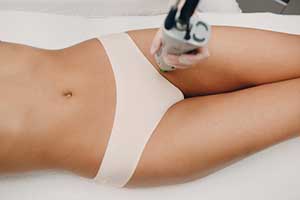 laser hair removal on the bikini area
