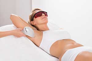 underarms laser hair removal treatment