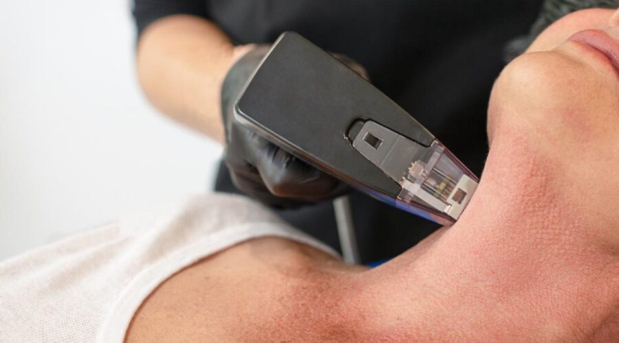 Woman receiving Morpheus8 treatment to her neck