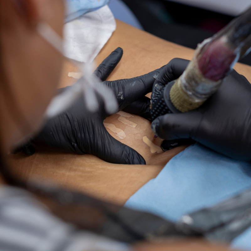 cosmetic makeup artist working on scar camouflage client